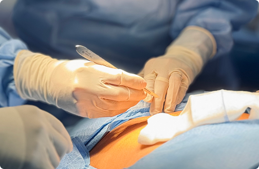 Imagen de postincisional